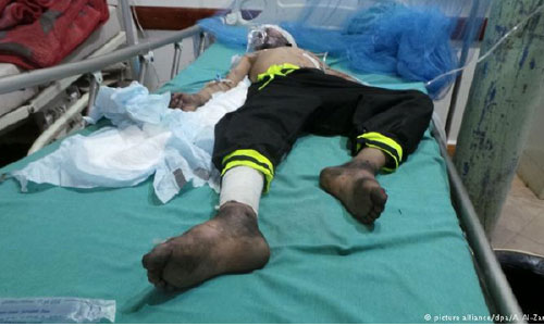  سازمان ملل: ده ها کودک در حمله هوایی عربستان کشته شدند