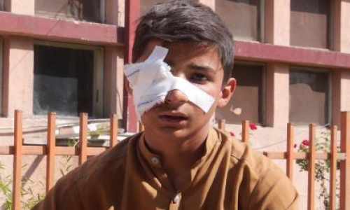 هسکې مېنې چاودنې د ۷۲ وژل شویو کسانو له ډلې ۲۷یې زده کوونکي وو 