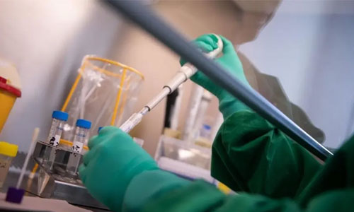 کرونا در افغانستان؛ با شناسایی ۵۸۱ مورد جدید، شمار مبتلایان به  هفت هزار و ۶۵۳ نفر رسید