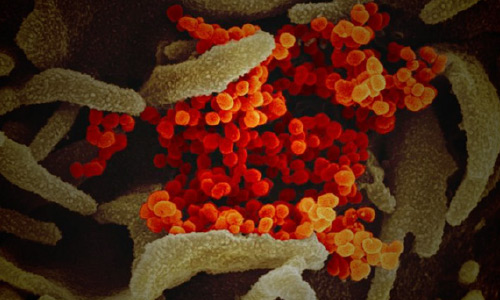 پزشک فرانسوی: داروی مالاریا برای درمان مبتلایان به کرونا موثر است 